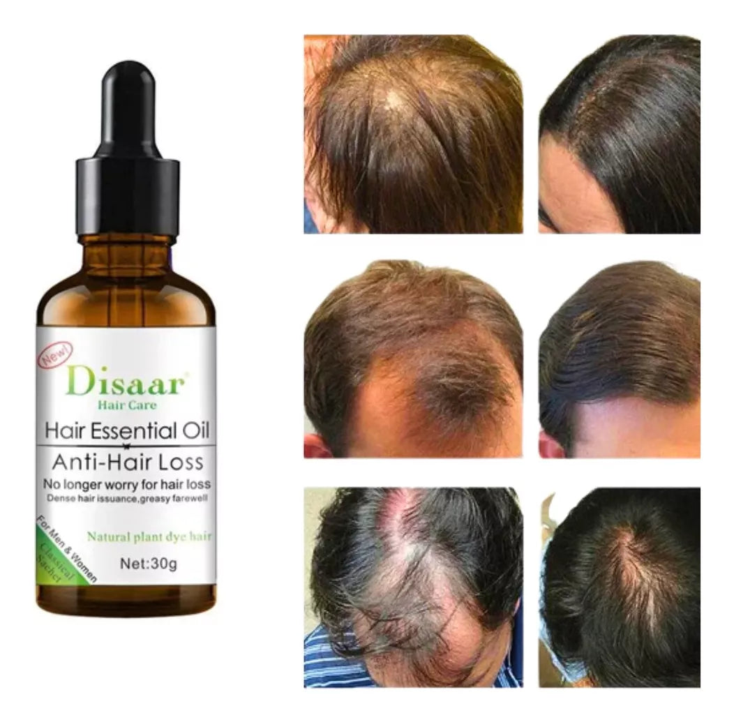 PACK SHAMPOO Y SERUM ANTICAIDA DISAAR